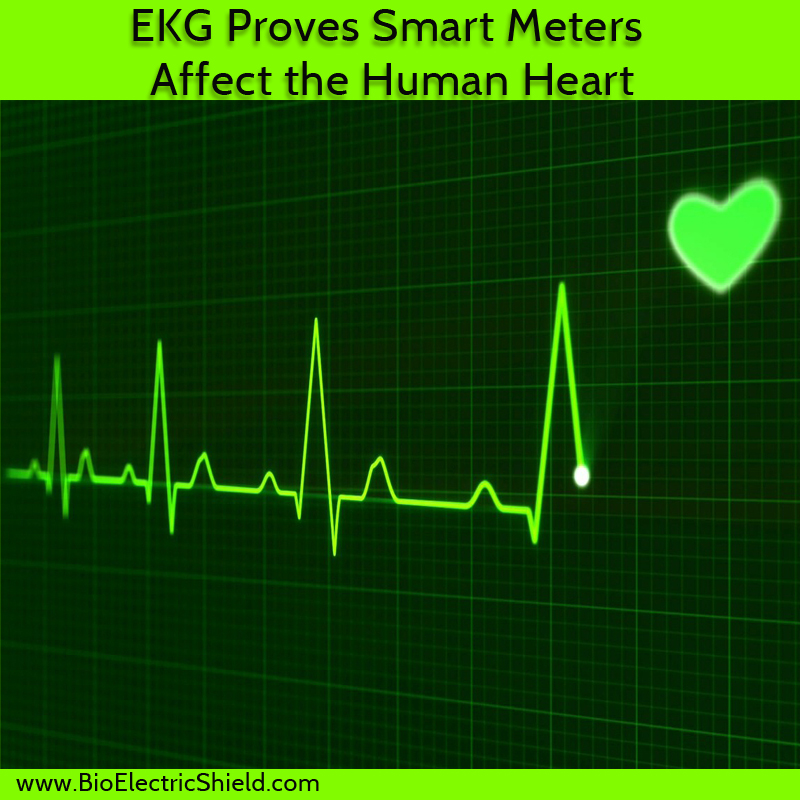 EKG showing affect of smart meter on human heart Smart Meters Affect the Heart